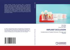 Bookcover of IMPLANT OCCLUSION