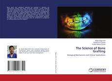 The Science of Bone Grafting的封面