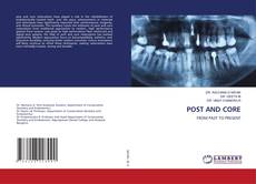 POST AND CORE的封面