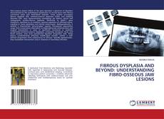 Buchcover von FIBROUS DYSPLASIA AND BEYOND: UNDERSTANDING FIBRO-OSSEOUS JAW LESIONS