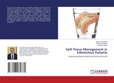 Copertina di Soft Tissue Management in Edentulous Patients
