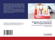Обложка Unlocking The Potential Of PRF In Implant Dentistry