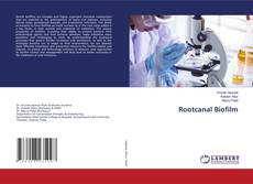 Обложка Rootcanal Biofilm