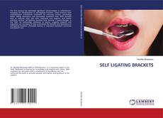 Borítókép a  SELF LIGATING BRACKETS - hoz