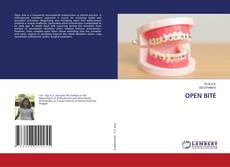 Bookcover of OPEN BITE