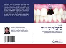 Обложка Implant Failure: Reasons and Conditions