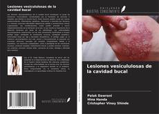 Copertina di Lesiones vesicululosas de la cavidad bucal