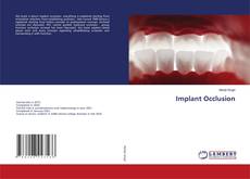 Borítókép a  Implant Occlusion - hoz