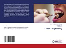 Buchcover von Crown Lengthening