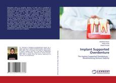 Implant Supported Overdenture的封面