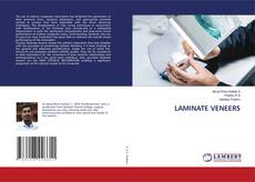 Copertina di LAMINATE VENEERS
