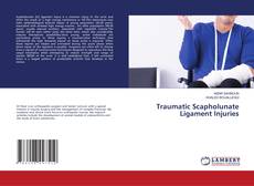Copertina di Traumatic Scapholunate Ligament Injuries