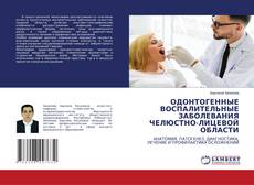 Обложка ОДОНТОГЕННЫЕ ВОСПАЛИТЕЛЬНЫЕ ЗАБОЛЕВАНИЯ ЧЕЛЮСТНО-ЛИЦЕВОЙ ОБЛАСТИ