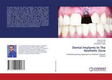 Dental Implants In The Aesthetic Zone的封面