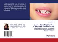 Guided Bone Regeneration in implant site development的封面