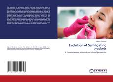 Copertina di Evolution of Self-ligating brackets