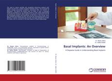 Обложка Basal Implants: An Overview