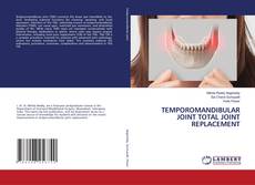 Capa do livro de TEMPOROMANDIBULAR JOINT TOTAL JOINT REPLACEMENT 