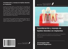 Portada del libro de Consideración y manejo de tejidos blandos en implantes