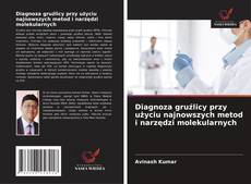 Diagnoza gruźlicy przy użyciu najnowszych metod i narzędzi molekularnych的封面