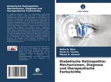 Bookcover of Diabetische Retinopathie: Mechanismen, Diagnose und therapeutische Fortschritte
