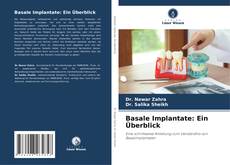 Capa do livro de Basale Implantate: Ein Überblick 