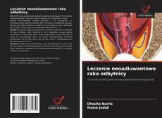 Leczenie neoadiuwantowe raka odbytnicy的封面