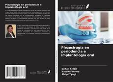 Piezocirugía en periodoncia e implantología oral的封面