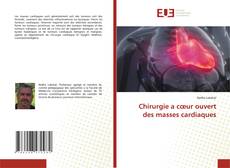 Copertina di Chirurgie a cœur ouvert des masses cardiaques
