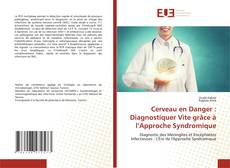 Copertina di Cerveau en Danger : Diagnostiquer Vite grâce à l’Approche Syndromique