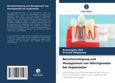 Portada del libro de Berücksichtigung und Management von Weichgewebe bei Implantaten
