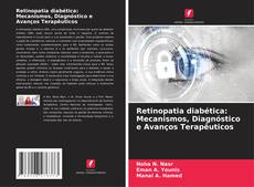 Couverture de Retinopatia diabética: Mecanismos, Diagnóstico e Avanços Terapêuticos