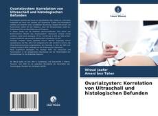 Bookcover of Ovarialzysten: Korrelation von Ultraschall und histologischen Befunden