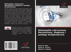 Retinopatia cukrzycowa: Mechanizmy, diagnoza i postępy terapeutyczne的封面