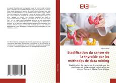 Couverture de Stadification du cancer de la thyroïde par les méthodes de data mining