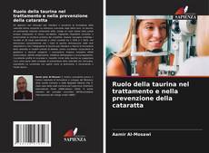 Buchcover von Ruolo della taurina nel trattamento e nella prevenzione della cataratta