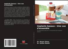 Couverture de Implants basaux : Une vue d'ensemble