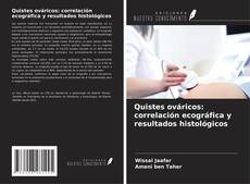 Bookcover of Quistes ováricos: correlación ecográfica y resultados histológicos