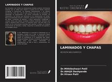 Bookcover of LAMINADOS Y CHAPAS