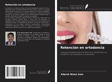 Retención en ortodoncia的封面