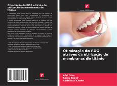 Couverture de Otimização do ROG através da utilização de membranas de titânio