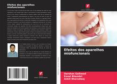 Couverture de Efeitos dos aparelhos miofuncionais