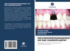 Portada del libro de WEICHGEWEBSMANAGEMENT UM DAS ZAHNIMPLANTAT