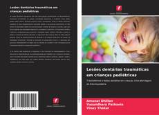 Couverture de Lesões dentárias traumáticas em crianças pediátricas