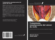 Copertina di Tratamiento neoadyuvante del cáncer de recto