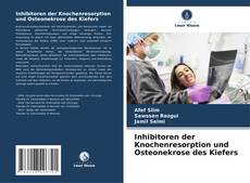 Bookcover of Inhibitoren der Knochenresorption und Osteonekrose des Kiefers