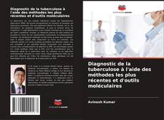 Diagnostic de la tuberculose à l'aide des méthodes les plus récentes et d'outils moléculaires的封面
