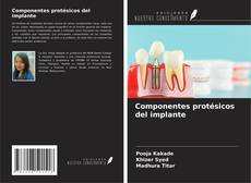 Buchcover von Componentes protésicos del implante