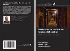 Обложка Artritis de la rodilla del minero del carbón