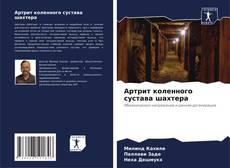 Bookcover of Артрит коленного сустава шахтера